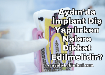 Aydın'da İmplant Diş Yapılırken Nelere Dikkat Edilmelidir?