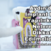 Aydın'da İmplant Diş Yapılırken Nelere Dikkat Edilmelidir?