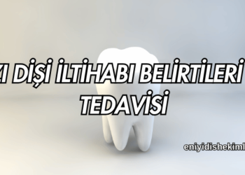 Azı Dişi İltihabı Belirtileri ve Tedavisi