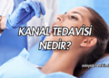 Kanal Tedavisi Nedir?