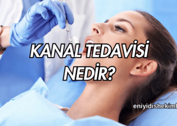 Kanal Tedavisi Nedir?