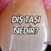 Diş Taşı Nedir?
