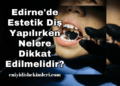 Edirne'de Estetik Diş Yapılırken Nelere Dikkat Edilmelidir?