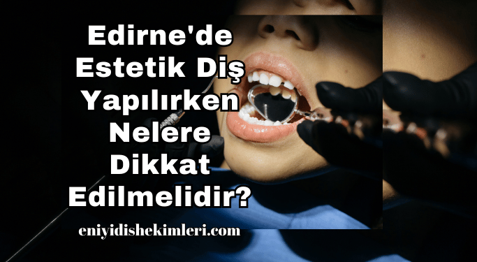 Edirne'de Estetik Diş Yapılırken Nelere Dikkat Edilmelidir?