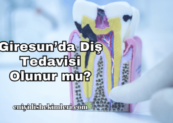 Giresun’da Diş Tedavisi Olunur mu?