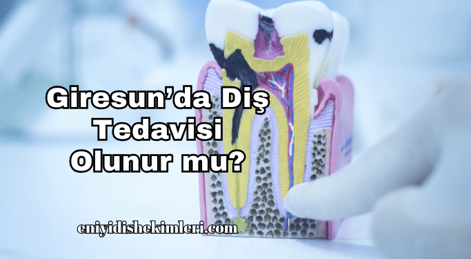 Giresun’da Diş Tedavisi Olunur mu?