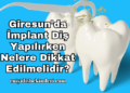 Giresun'da İmplant Diş Yapılırken Nelere Dikkat Edilmelidir?