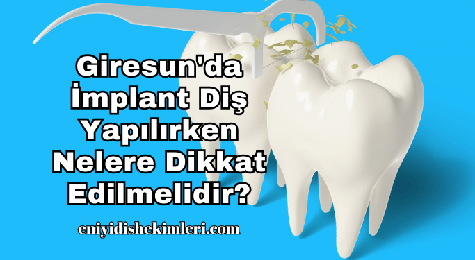 Giresun'da İmplant Diş Yapılırken Nelere Dikkat Edilmelidir?