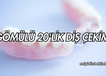 Gömülü 20'lik Diş Çekimi