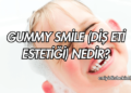 Gummy Smile (Diş Eti Estetiği) Nedir?