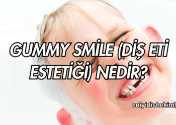 Gummy Smile (Diş Eti Estetiği) Nedir?