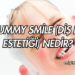 Gummy Smile (Diş Eti Estetiği) Nedir?