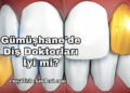 Gümüşhane'de Diş Doktorları İyi mi?
