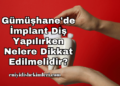 Gümüşhane'de İmplant Diş Yapılırken Nelere Dikkat Edilmelidir?