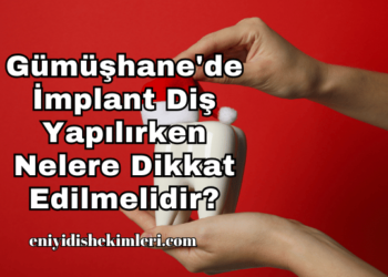 Gümüşhane'de İmplant Diş Yapılırken Nelere Dikkat Edilmelidir?