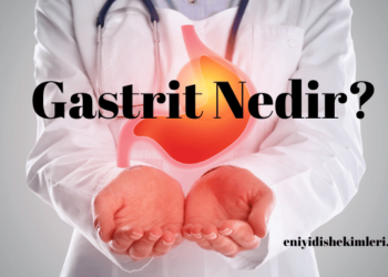 Gastrit Nedir?