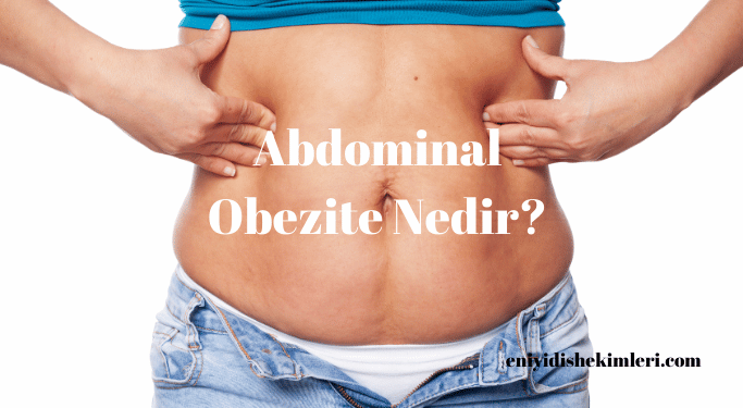 Abdominal Obezite Nedir?