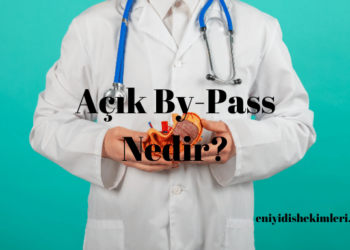 Açık By-Pass Nedir?