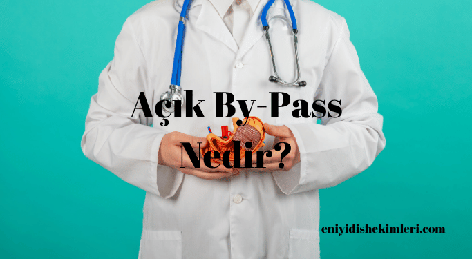 Açık By-Pass Nedir?