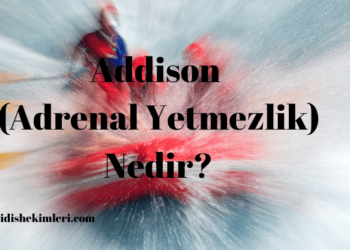 Addison (Adrenal Yetmezlik) Nedir?