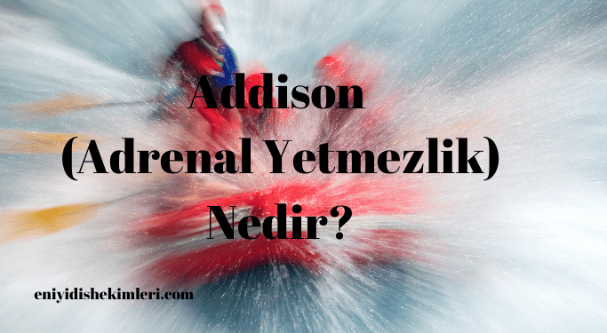 Addison (Adrenal Yetmezlik) Nedir?