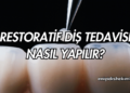 Restoratif Diş Tedavisi Nasıl Yapılır?