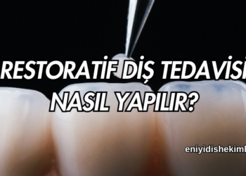 Restoratif Diş Tedavisi Nasıl Yapılır?