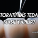 Restoratif Diş Tedavisi Nasıl Yapılır?