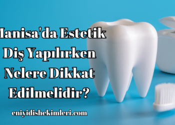Manisa'da Estetik Diş Yapılırken Nelere Dikkat Edilmelidir?
