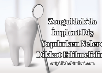 Zonguldak'da İmplant Diş Yapılırken Nelere Dikkat Edilmelidir?