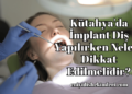 Kütahya'da İmplant Diş Yapılırken Nelere Dikkat Edilmelidir?