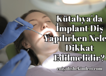 Kütahya'da İmplant Diş Yapılırken Nelere Dikkat Edilmelidir?