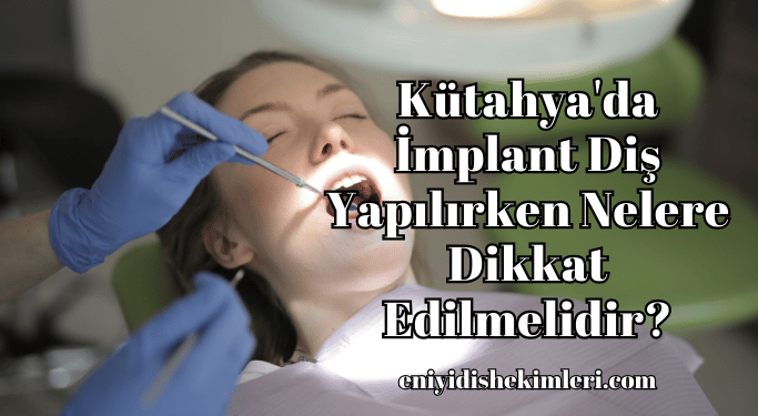 Kütahya'da İmplant Diş Yapılırken Nelere Dikkat Edilmelidir?