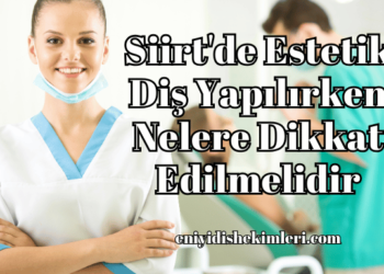 Siirt'de Estetik Diş Yapılırken Nelere Dikkat Edilmelidir