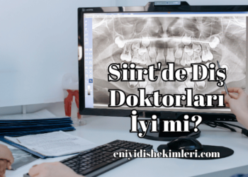 Siirt'de Diş Doktorları İyi mi?