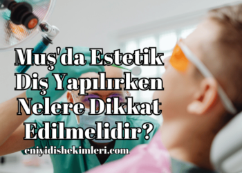 Muş'da Estetik Diş Yapılırken Nelere Dikkat Edilmelidir?