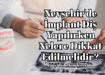 Nevşehir'de İmplant Diş Yapılırken Nelere Dikkat Edilmelidir?
