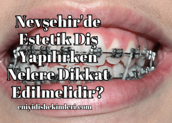 Nevşehir'de Estetik Diş Yapılırken Nelere Dikkat Edilmelidir?
