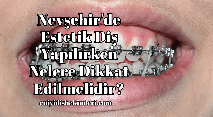 Nevşehir'de Estetik Diş Yapılırken Nelere Dikkat Edilmelidir?