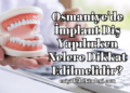Osmaniye'de İmplant Diş Yapılırken Nelere Dikkat Edilmelidir?