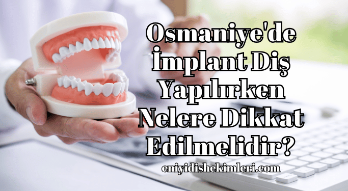 Osmaniye'de İmplant Diş Yapılırken Nelere Dikkat Edilmelidir?