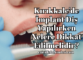 Kırıkkale'de İmplant Diş Yapılırken Nelere Dikkat Edilmelidir?