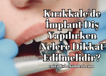 Kırıkkale'de İmplant Diş Yapılırken Nelere Dikkat Edilmelidir?