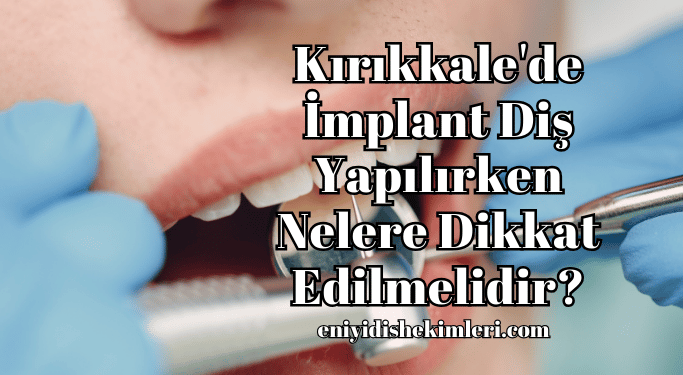 Kırıkkale'de İmplant Diş Yapılırken Nelere Dikkat Edilmelidir?