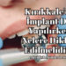 Kırıkkale'de İmplant Diş Yapılırken Nelere Dikkat Edilmelidir?