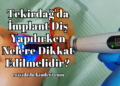Tekirdağ'da İmplant Diş Yapılırken Nelere Dikkat Edilmelidir?