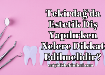 Tekirdağ'da Estetik Diş Yapılırken Nelere Dikkat Edilmelidir?