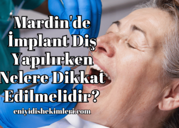 Mardin'de İmplant Diş Yapılırken Nelere Dikkat Edilmelidir?