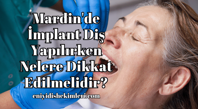 Mardin'de İmplant Diş Yapılırken Nelere Dikkat Edilmelidir?