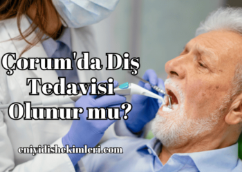 Çorum'da Diş Tedavisi Olunur mu?